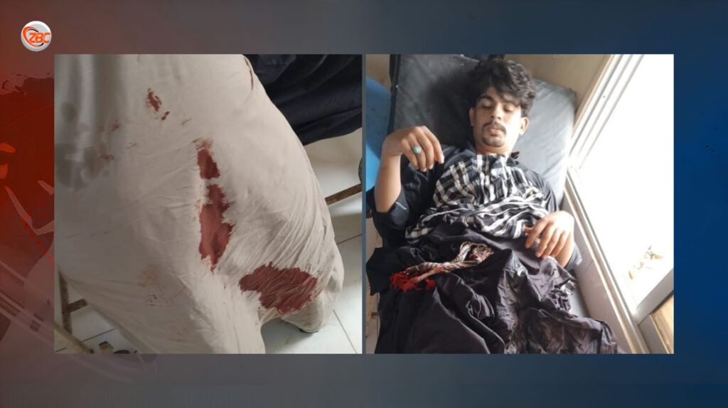 لسبیلہ یونیورسٹی میں بلوچ طلباء کے پرامن احتجاجی کیمپ پر حملہ، فائرنگ سے متعدد زخمی اور گرفتاریاں